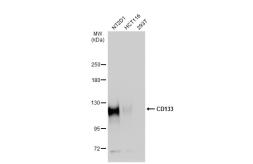 Anti-CD133 antibody [N1C1] used in Western Blot (WB). GTX102109
