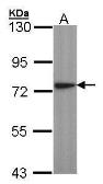 Anti-Lysyl-tRNA synthetase antibody used in Western Blot (WB). GTX102113