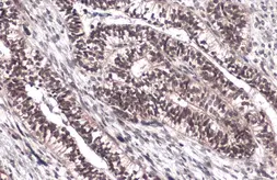 Anti-FOXM1 antibody used in IHC (Paraffin sections) (IHC-P). GTX102126