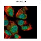 Anti-RAN antibody used in Immunocytochemistry/ Immunofluorescence (ICC/IF). GTX102129