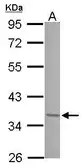 Anti-JunD antibody [N1C1] used in Western Blot (WB). GTX102135