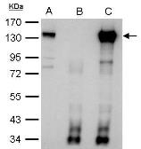 Anti-CIZ1 antibody [N2C1], Internal used in Immunoprecipitation (IP). GTX102144
