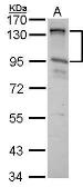 Anti-CIZ1 antibody [N2C1], Internal used in Western Blot (WB). GTX102144