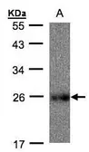 Anti-UQCRFS1 antibody [N1C3] used in Western Blot (WB). GTX102150