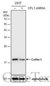 Anti-Cofilin 1 antibody used in Western Blot (WB). GTX102156