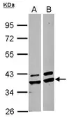 Anti-AKR1A1 antibody [N1C1] used in Western Blot (WB). GTX102159