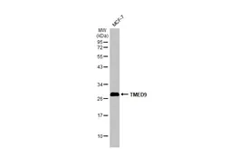 Anti-TMED9 antibody [N1C3] used in Western Blot (WB). GTX102163
