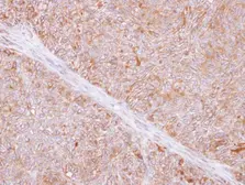 Anti-TMED9 antibody [N1C3] used in IHC (Paraffin sections) (IHC-P). GTX102163