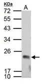 Anti-APOBEC3C antibody used in Western Blot (WB). GTX102164