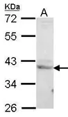 Anti-LZIP antibody [C1C3] used in Western Blot (WB). GTX102169