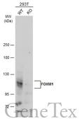 Anti-FOXM1 antibody used in Western Blot (WB). GTX102170