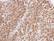 Anti-KIAA0494 antibody [N3C3] used in IHC (Paraffin sections) (IHC-P). GTX102173