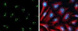 Anti-PAF49 antibody used in Immunocytochemistry/ Immunofluorescence (ICC/IF). GTX102175