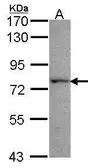 Anti-Lysyl-tRNA synthetase antibody used in Western Blot (WB). GTX102179
