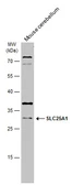 Anti-SLC25A1 antibody [N1C1] used in Western Blot (WB). GTX102191