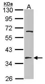 Anti-TSFM antibody [N1C1] used in Western Blot (WB). GTX102192