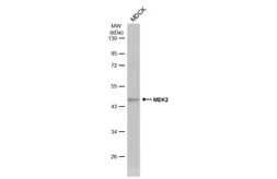 Anti-MEK2 antibody [N1C1] used in Western Blot (WB). GTX102198