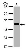 Anti-MEK2 antibody [N1C1] used in Western Blot (WB). GTX102198