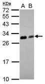 Anti-14-3-3 theta antibody used in Western Blot (WB). GTX102199