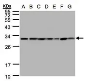 Anti-14-3-3 theta antibody used in Western Blot (WB). GTX102199