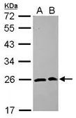 Anti-SAR1A antibody [N1C3] used in Western Blot (WB). GTX102204