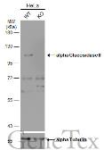 Anti-alpha Glucosidase II antibody [C2C3], C-term used in Western Blot (WB). GTX102205