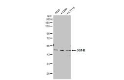 Anti-OST48 antibody [C1C3] used in Western Blot (WB). GTX102211