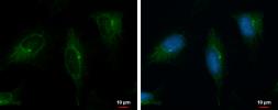 Anti-PKD2 antibody [C1C3] used in Immunocytochemistry/ Immunofluorescence (ICC/IF). GTX102212