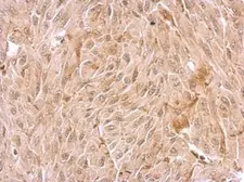 Anti-WDR1 antibody used in IHC (Paraffin sections) (IHC-P). GTX102214