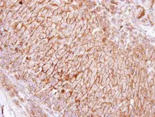 Anti-SCAMP3 antibody [N1N3] used in IHC (Paraffin sections) (IHC-P). GTX102216