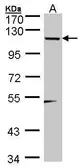 Anti-TSHZ1 antibody [N3C2], Internal used in Western Blot (WB). GTX102219