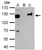 Anti-KAP1 antibody [N3C2], Internal used in Immunoprecipitation (IP). GTX102226