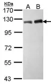 Anti-KAP1 antibody [N1N2], N-term used in Western Blot (WB). GTX102227