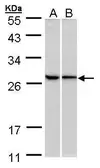 Anti-RPL13A antibody [N1C3] used in Western Blot (WB). GTX102228