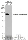 Anti-alpha Glucosidase II antibody [N1N2], N-term used in Western Blot (WB). GTX102237