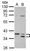 Anti-TSFM antibody used in Western Blot (WB). GTX102238