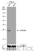Anti-LYPLA2 antibody [N1C3] used in Western Blot (WB). GTX102240