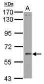 Anti-WDR1 antibody used in Western Blot (WB). GTX102247