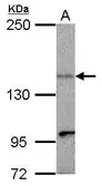 Anti-KIF1C antibody [N3C2], Internal used in Western Blot (WB). GTX102264