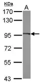 Anti-eEF2 antibody [C1C3] used in Western Blot (WB). GTX102286