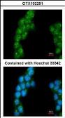 Anti-Proteasome 26S S3 antibody [C1C3] used in Immunocytochemistry/ Immunofluorescence (ICC/IF). GTX102291