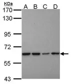 Anti-Proteasome 26S S3 antibody [C1C3] used in Western Blot (WB). GTX102291