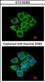 Anti-EEF1D antibody [N1C3] used in Immunocytochemistry/ Immunofluorescence (ICC/IF). GTX102292