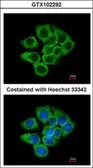 Anti-EEF1D antibody [N1C3] used in Immunocytochemistry/ Immunofluorescence (ICC/IF). GTX102292