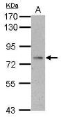 Anti-ALS antibody used in Western Blot (WB). GTX102294