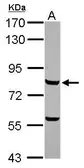 Anti-c-Myb antibody [N2C1], Internal used in Western Blot (WB). GTX102305