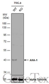 Anti-AHA-1 antibody [N1C1] used in Western Blot (WB). GTX102312