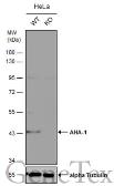 Anti-AHA-1 antibody [N2C3] used in Western Blot (WB). GTX102321