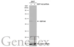 Anti-EEF1A2 antibody used in Western Blot (WB). GTX102326