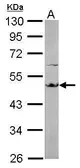 Anti-EEF1A2 antibody [C1C3] used in Western Blot (WB). GTX102327